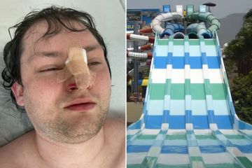 Sufrí una herida de horror en el tobogán de agua de Tenerife que me costó £ 1,400